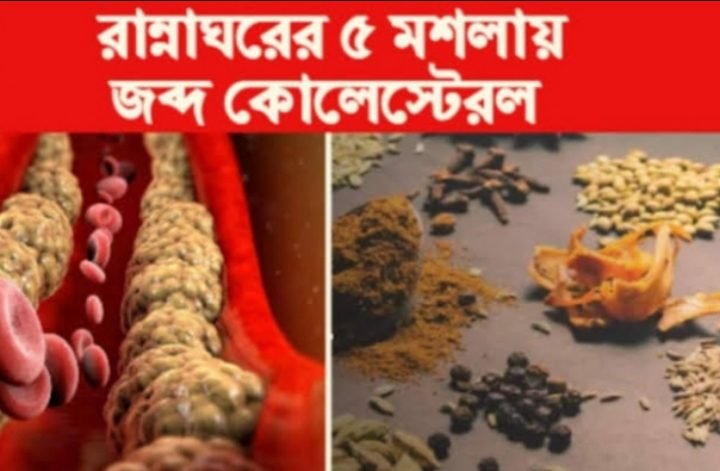 উচ্চ কোলেস্টেরল কমাতে দৈনিক ব্যবহার করুন কিছু পরিচিত মশলা